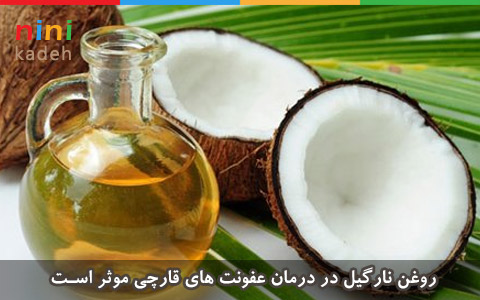 عفونت قارچی واژن